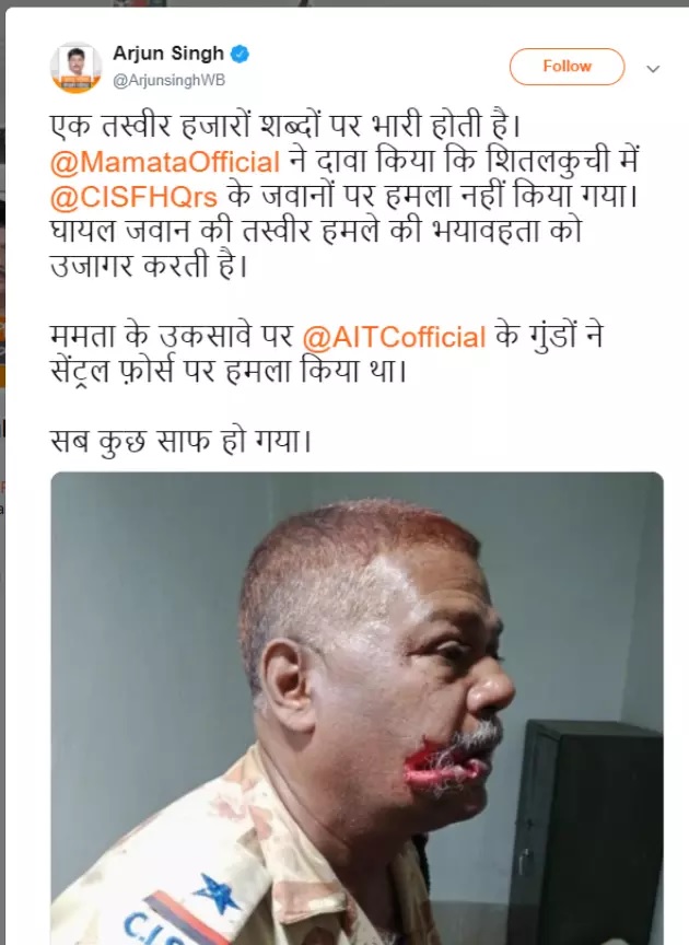 पश्चिम बंगाल हिंसा में घायल हुए CISF जवान 