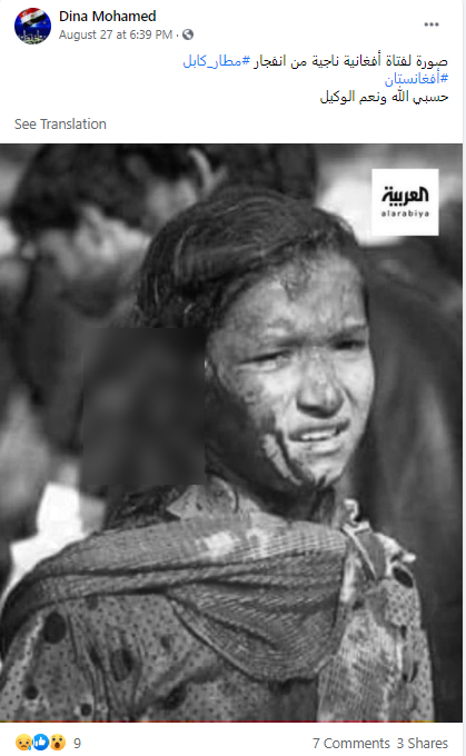 زخمی لڑکی کی وائرل تصویر کا اسکرین شارٹ