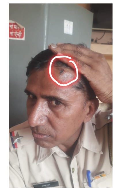 ਪੁਲਿਸ ਮੁਲਾਜ਼ਮ ਨੇ ਜ਼ਖ਼ਮੀ ਹੋਣ ਦਾ ਕੀਤਾ ਨਾਟਕ