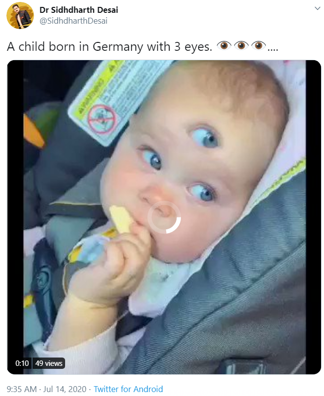 کیا تین آنکھوں والا بچہ دنیاں میں جنم لیا ہے؟سچ ہے یا افواہ؟پڑھیئے ہماری تحقیق