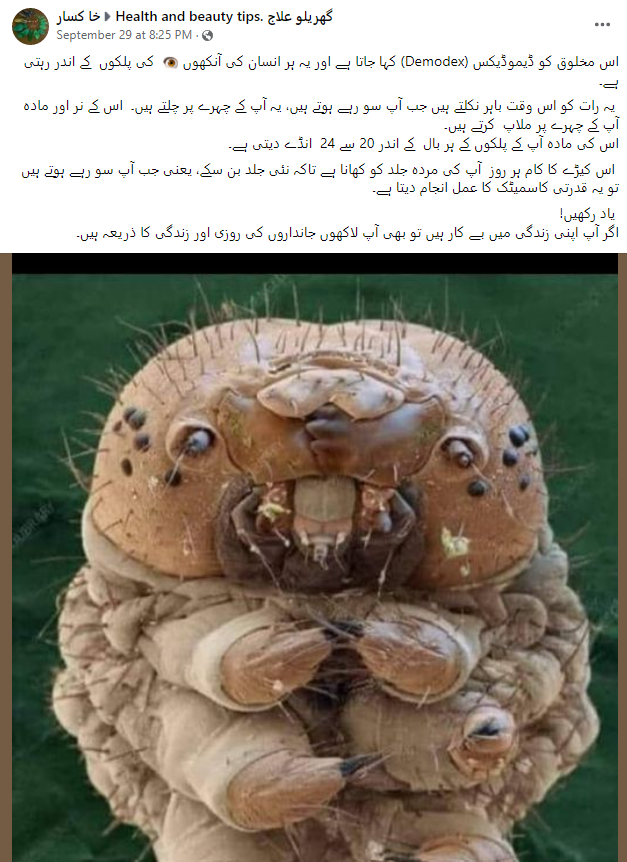  انسانی چہرے پر رہنے والے کیڑے ڈیموڈیکس کی نہیں ہے یہ تصویر