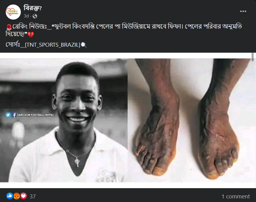 কিংবদন্তি ফুটবলার পেলের দুটি পা image 1