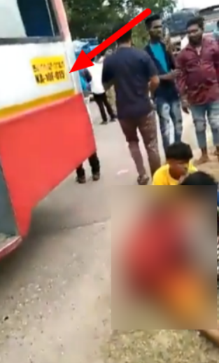कर्नाटकात मोफत बस प्रवास योजनेचा लाभ घेण्याच्या प्रयत्नात महिलेने हात गमावला? नाही, व्हायरल दावा खोटा आहे