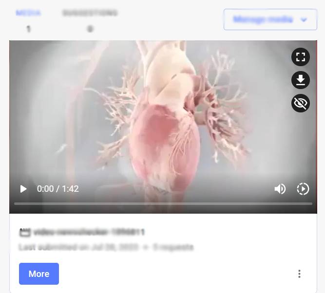 Fact Check: जे. जे. हॉस्पिटलमध्ये नवीन अँजिओग्राफी पद्धत फक्त ₹5000 मध्ये? खोटा आहे हा दावा