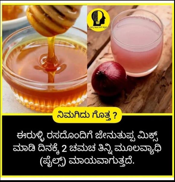 Fact Check: ಈರುಳ್ಳಿ ರಸ ಮತ್ತು ಜೇನುತುಪ್ಪ ಮಿಶ್ರಣ ಮೂಲವ್ಯಾಧಿ ಗುಣಪಡಿಸುತ್ತದೆಯೇ?