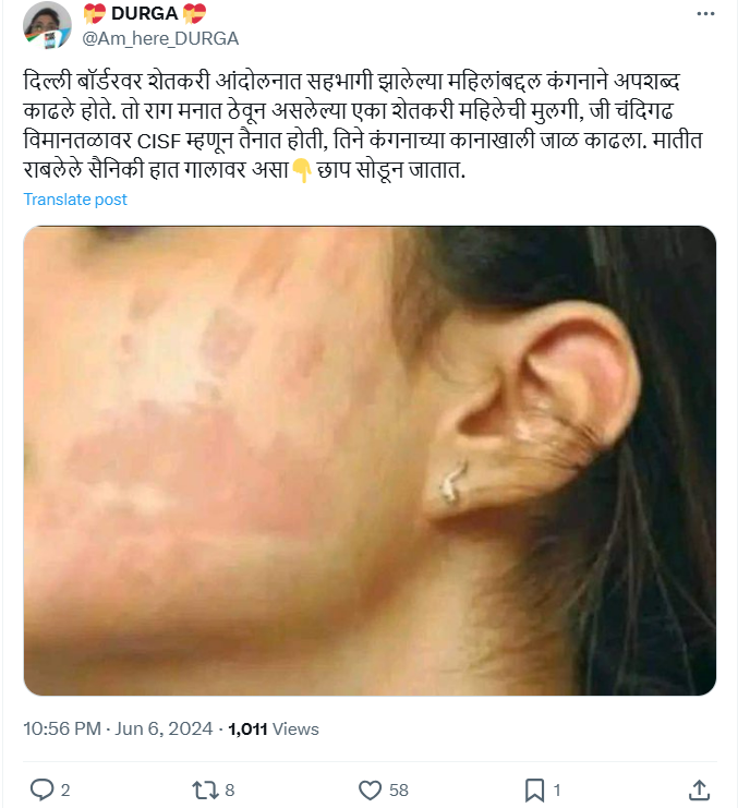 Fact Check: कंगना राणावतच्या गालावर उमटलेली थप्पडेची खूण असल्याचे सांगत व्हायरल झालेल्या फोटोचे सत्य जाणून घ्या